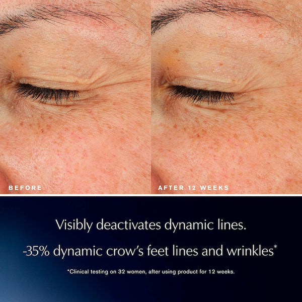 Advanced Night Repair
Eye Lift + Sculpt Eye Cream