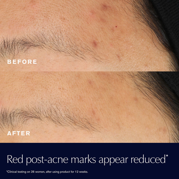 Advanced Night Repair
Rescue Solution Serum with 15% Bifidus Ferment